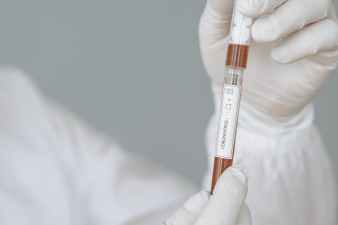 person holding test tube and syringe